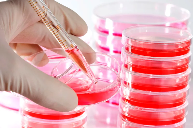 Image of YEAST EXTRACT AGAR